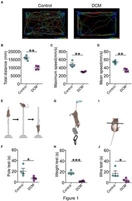 Impaired communication at the neuromotor axis during Degenerative Cervical Myelopathy
